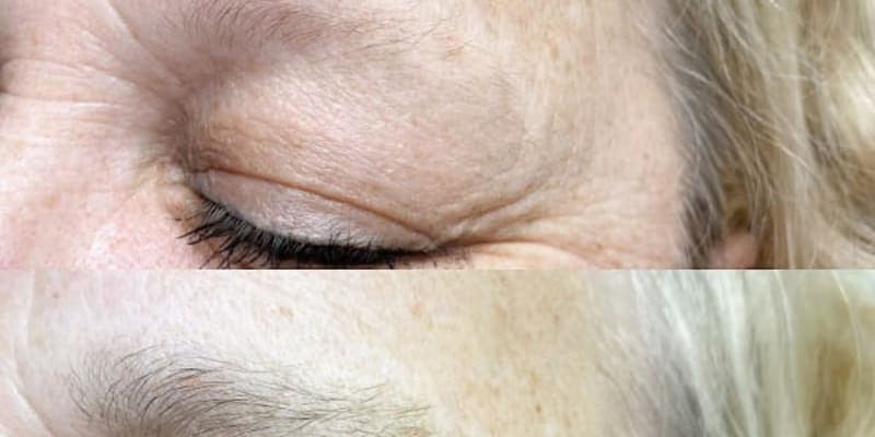 AME's Skin Therapy