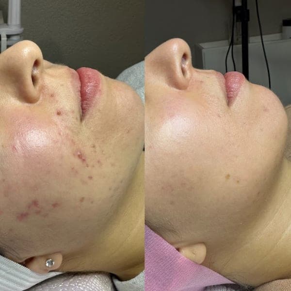 Ritual Esthetics cover photo - beauty in DFW, TX