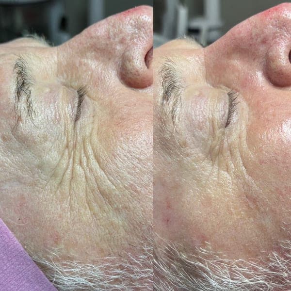 Ritual Esthetics photo 2 - beauty in DFW, TX