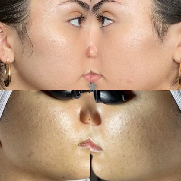 Ritual Esthetics photo 3 - beauty in DFW, TX