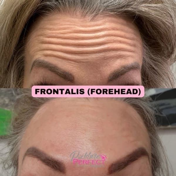 Pickture Perfect Medspa photo 2 - beauty in DFW, TX