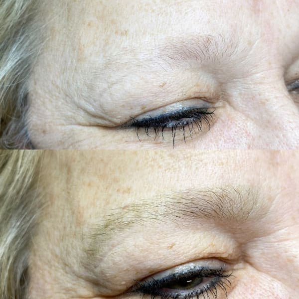 AME's Skin Therapy photo 2 - beauty in DFW, TX