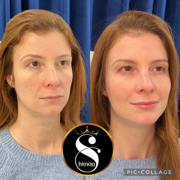 Shimaa Beauty Center Arlington cover photo - beauty in DFW, TX